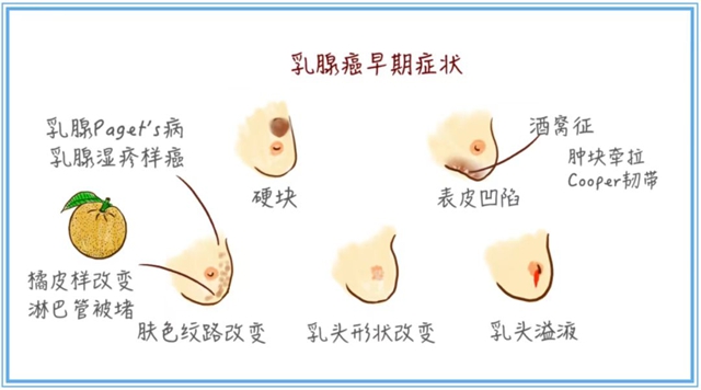 乳3.jpg