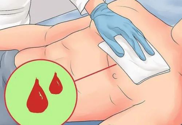 警察光荣牺牲!被刺中大腿动脉还可以抢救吗?(图4) 64007.jpg