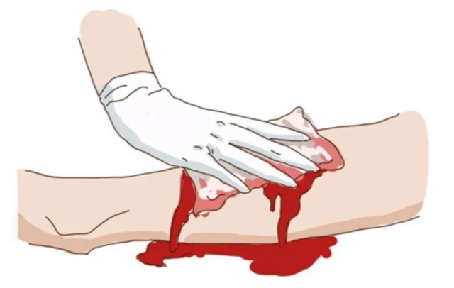 警察光荣牺牲!被刺中大腿动脉还可以抢救吗?(图6) 64009.jpg