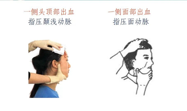 警察光荣牺牲!被刺中大腿动脉还可以抢救吗?(图7) 64010.jpg