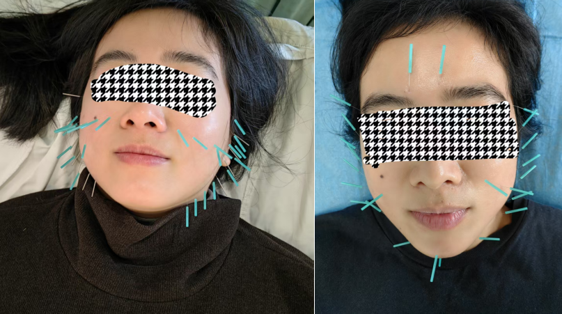 牙3.png