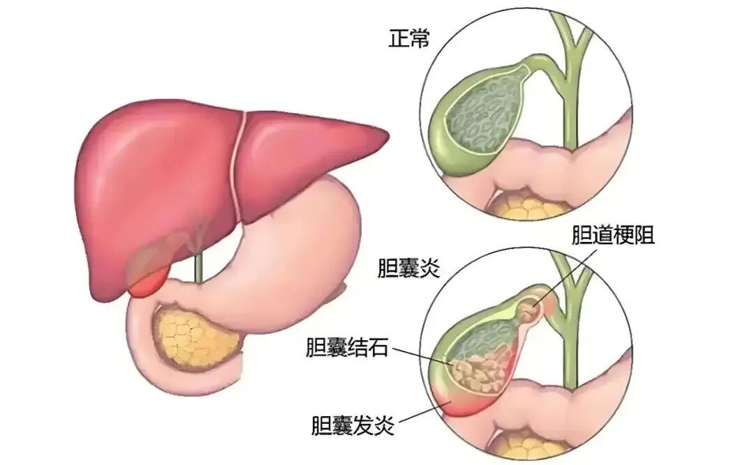 万4.jpg