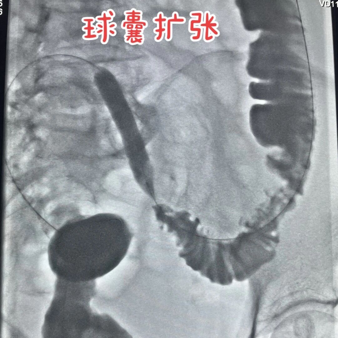 血3.jpg