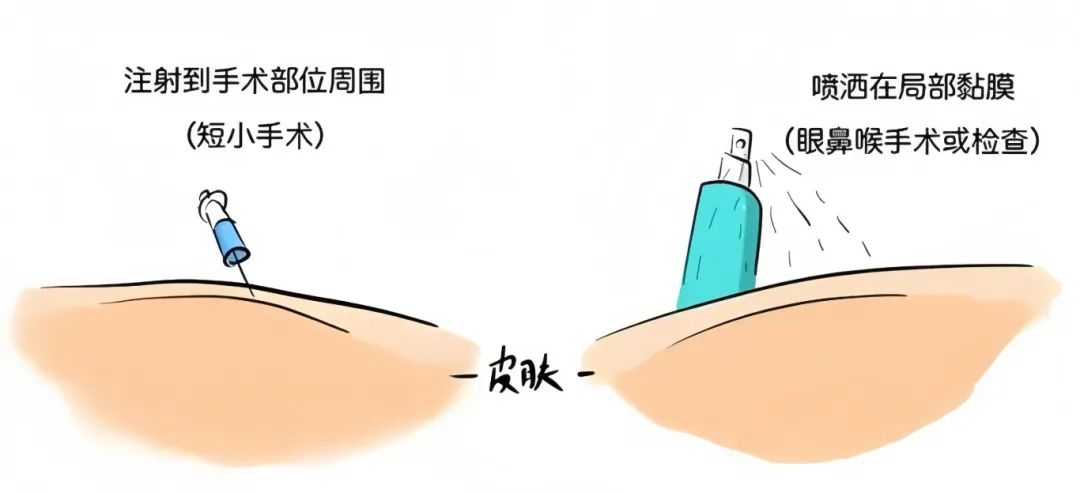 麻4.png