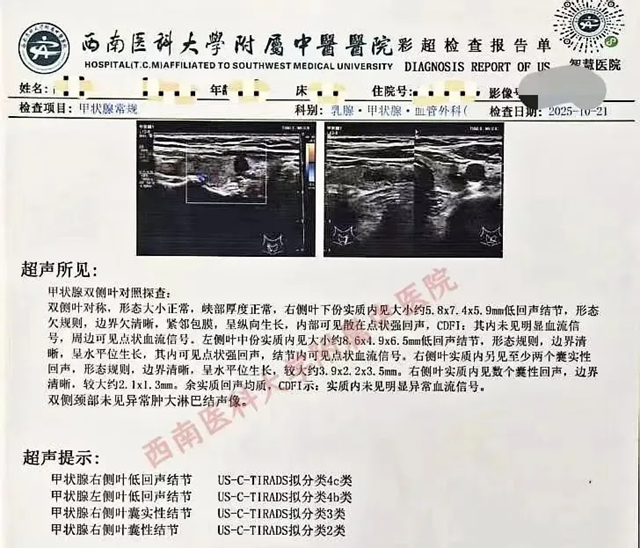 体检发现4c类结节，彻底慌了？