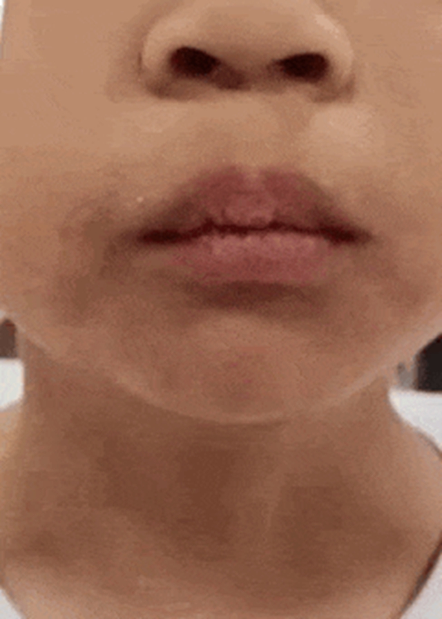 口水5.jpg