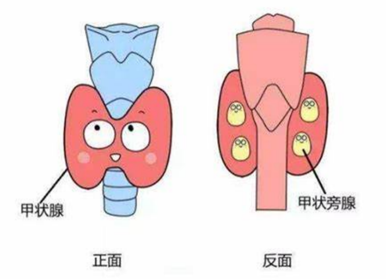 【科普】肾结石反复发作？元凶竟在脖子上！