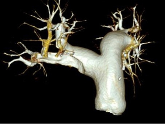 呼吸9.jpg