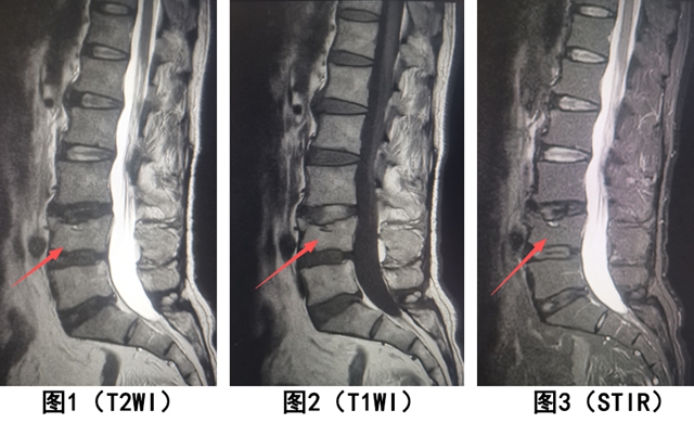 骨3.jpg