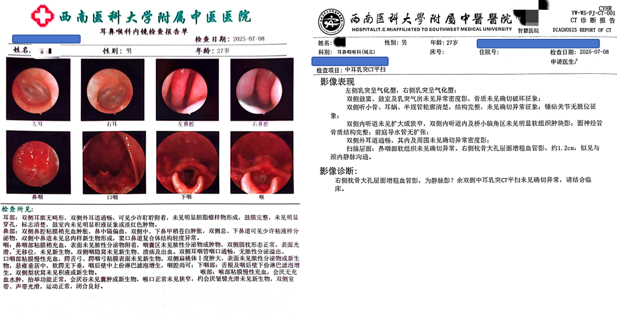 年轻小伙压不住的耳鸣、失眠，中医“鬼”针1针就消音