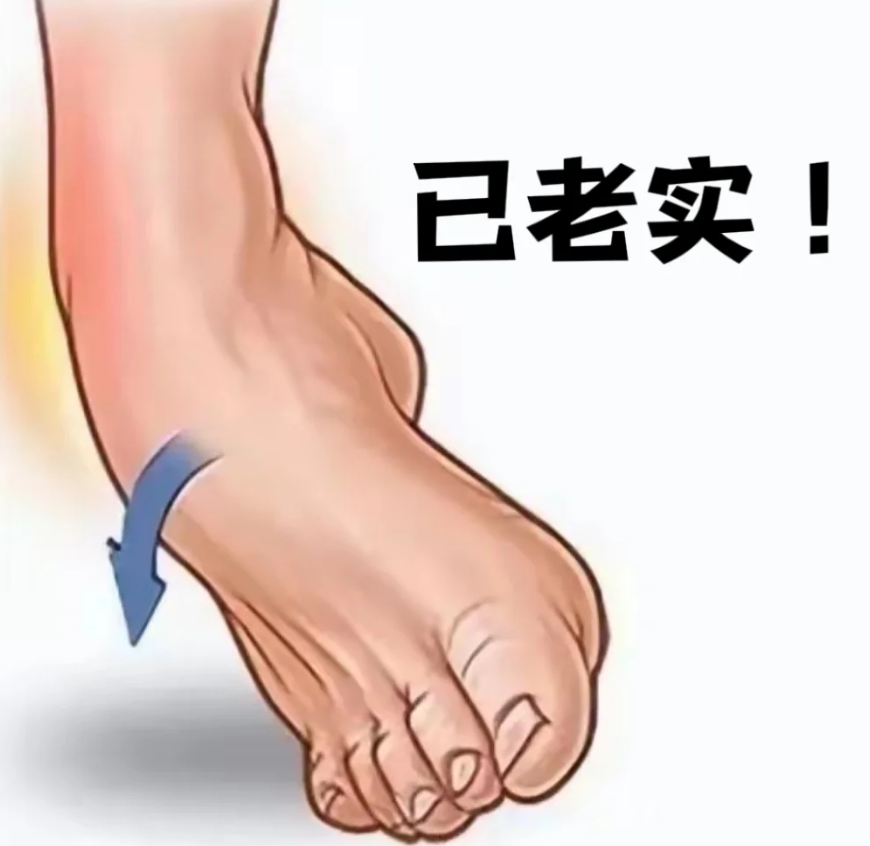 【科普】听说崴脚=挡灾?(图2) 2.png