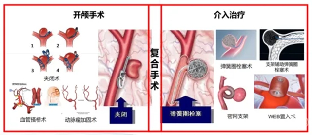脑4.jpg
