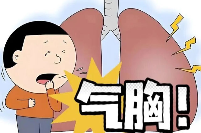 运动后突发胸痛?当心气胸“偷袭”!(图4) 4.jpg