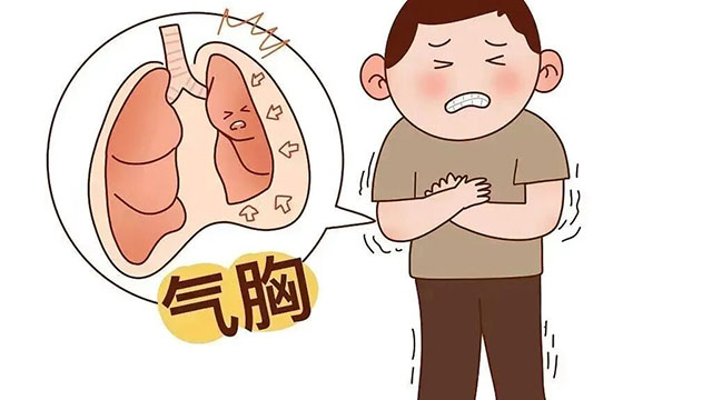 运动后突发胸痛?当心气胸“偷袭”!(图5) 5.jpg