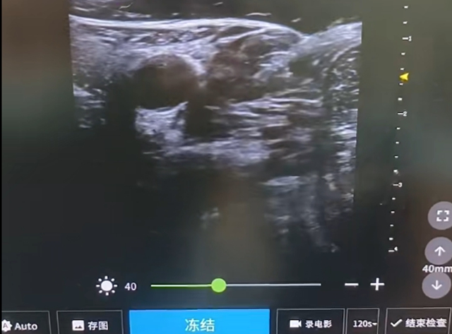 扎2.jpg