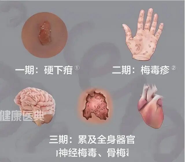 痛3.jpg