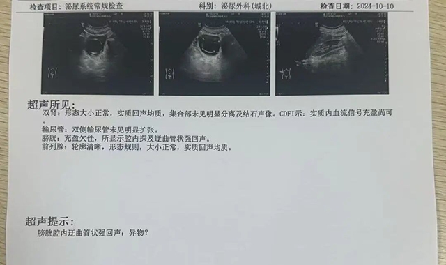 尿1.jpg