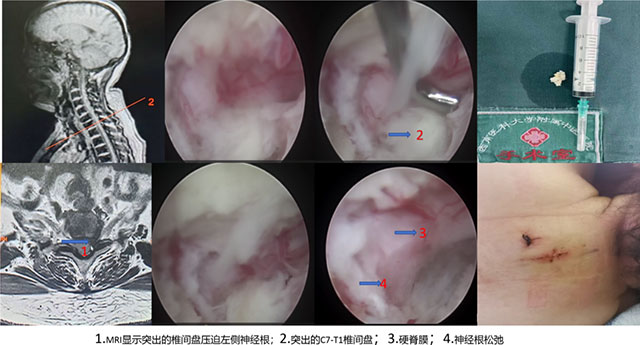 痛痛痛，痛到睡不着！