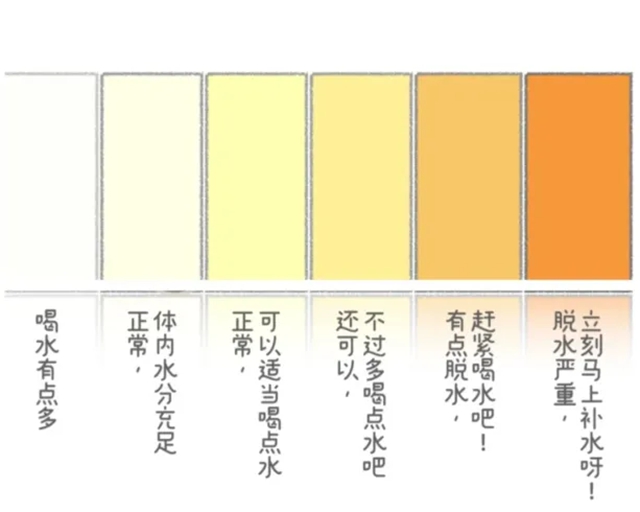 结石4.jpg