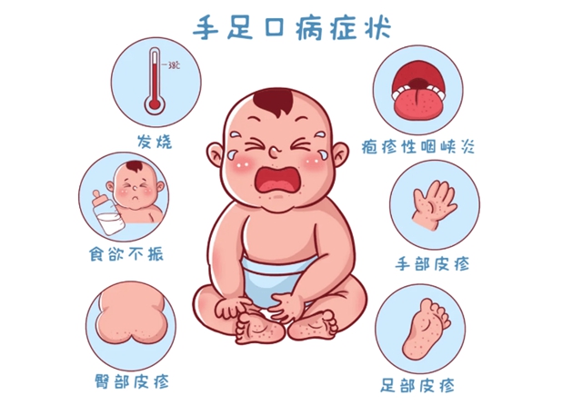手1.jpg