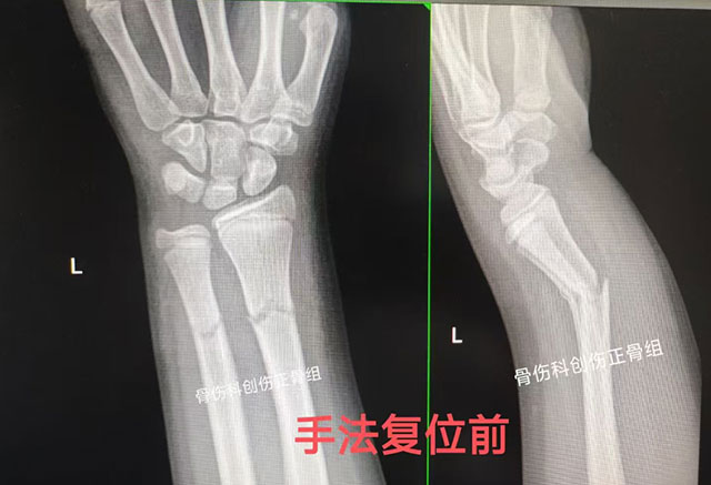 多名小孩手臂被da弯,结果……(图6) 6.jpg