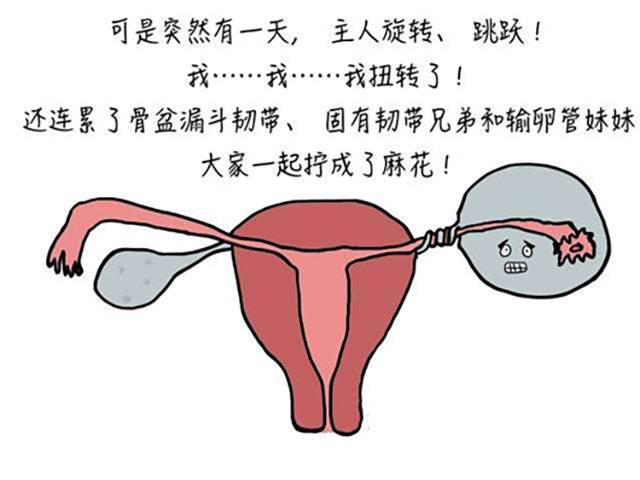 17岁女孩腹痛呕吐，卵巢扭了540度成“麻花”