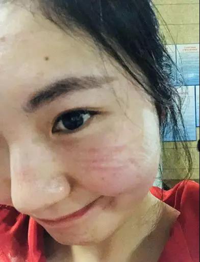 宜宾江安确诊患者治愈出院！10名医护人员解除隔离(图5)