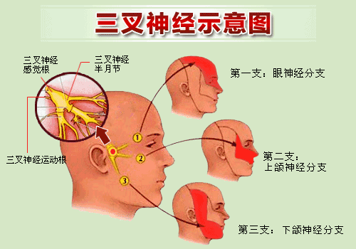 大妈被拔光牙齿，没想到得的是三叉神经痛！(图4)