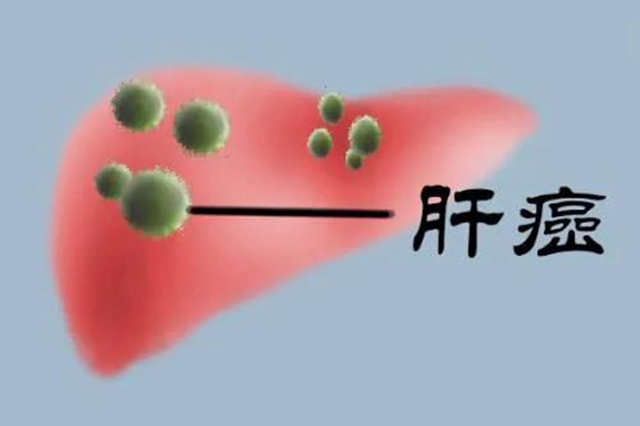 【扩散】得了肝癌，可以来这里免费治疗！(图7)
