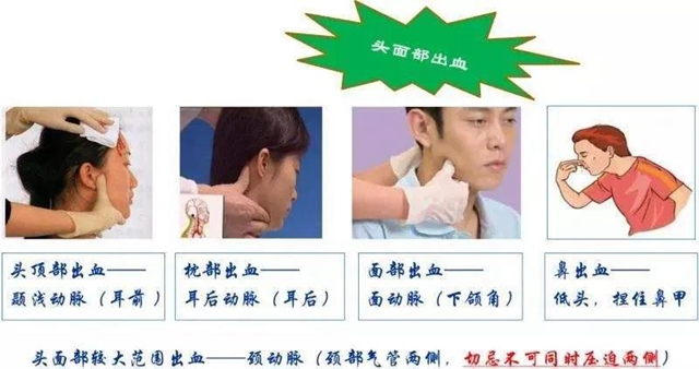 【关注】七旬婆婆意外摔伤头部，流血不止……(图4)