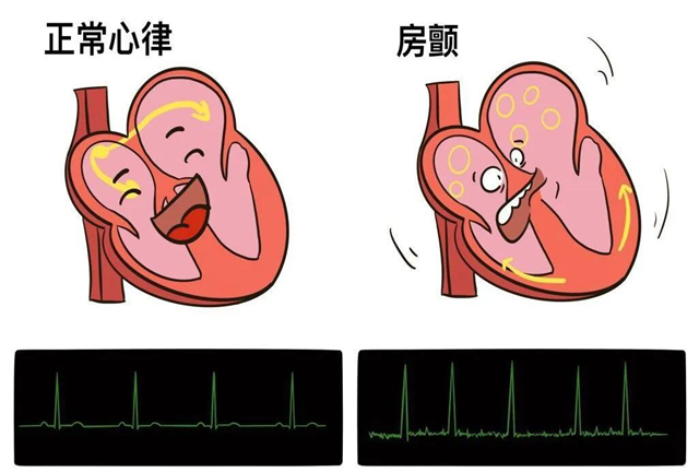房颤患者福音!西南医大中医院又添1个国家级中心(图8) 房颤患者福音!西南医大中医院又添1个国家级中心(图8)