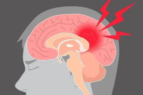 房颤患者福音!西南医大中医院又添1个国家级中心(图10) 房颤患者福音!西南医大中医院又添1个国家级中心(图10)
