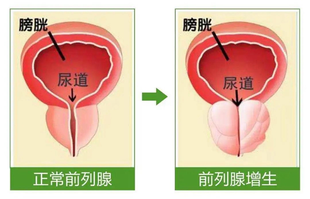 【关注】93岁大爷的“男”言之隐？差点……(图7)