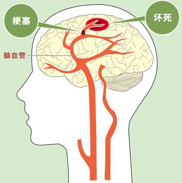 【冬季高发】6个危险信号一定要警惕！(图4)