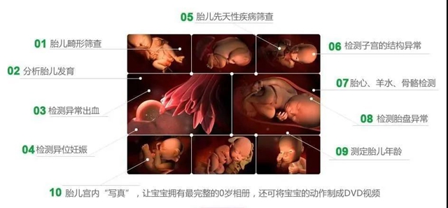 【扩散】害怕宝宝先天畸形?这项检查不可忽视!(图5) 【扩散】害怕宝宝先天畸形?这项检查不可忽视!(图5)