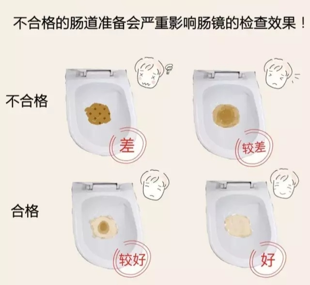 【扩散】高大上！做胃肠镜有新变化？(图16)