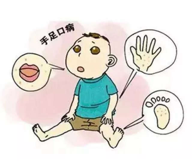 7月,泸州市民要关注这些疾病!(图6) 7月,泸州市民要关注这些疾病!(图6)