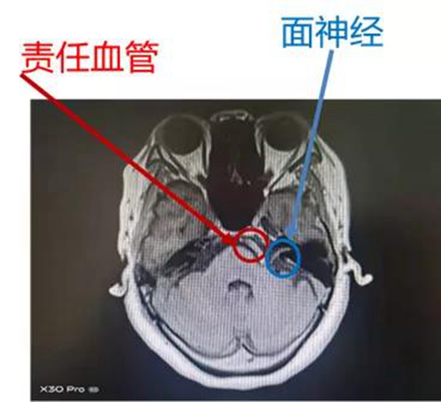【围观】一女子刷刷抖音，就解决了困扰十年的疾病？(图4)