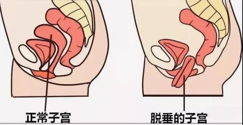 【扩散】88岁老奶奶下体掉了块“肉”？(图3)