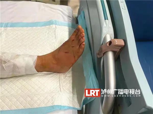 18人被咬伤住院！“烙铁头”出没，泸州人小心
