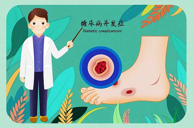 【关注】糖尿病患者该怎么吃?看这一篇就够啦!(图4) nEO_IMG_3.jpg