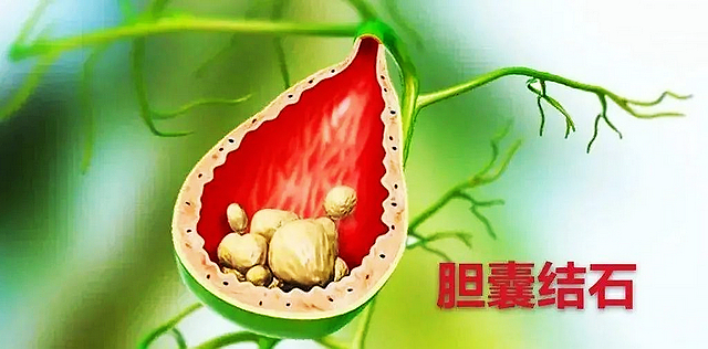 【围观】差点就癌变,30分钟解决(图6) nEO_IMG_6.jpg
